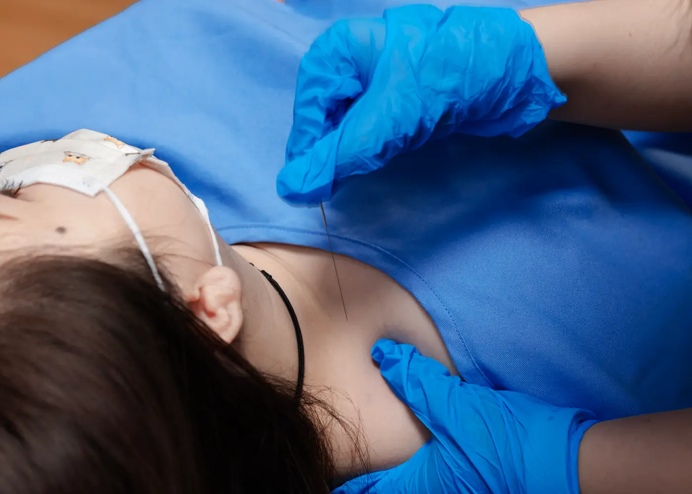 Gloved practitioner placing a single-use needle into a trigger point in a patient shoulder at Persistence Chiropractic Care in Cheras, Kuala Lumpur
